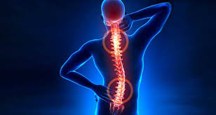 Hernia de disco tratamiento quiropráctico