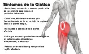 ciática quiropractica